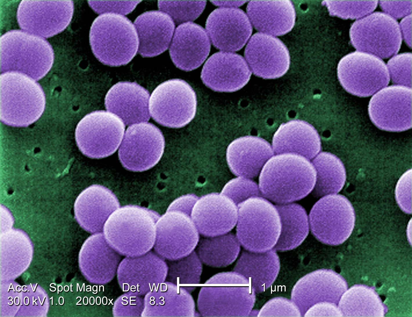 Staphylococcus, a common bacteria, can be used to attack and kill dangerous bacteria, including 'superbugs' which have become progressively resistant to antibiotics. – Pic courtesy of Wikipedia, February 29, 2016.